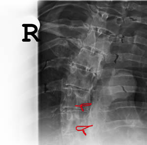 radiografia